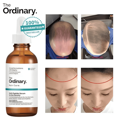Sérum Capilar The Ordinary Multi-Péptido 30ml | Recupera tu Cabello desde la Raíz 🤩