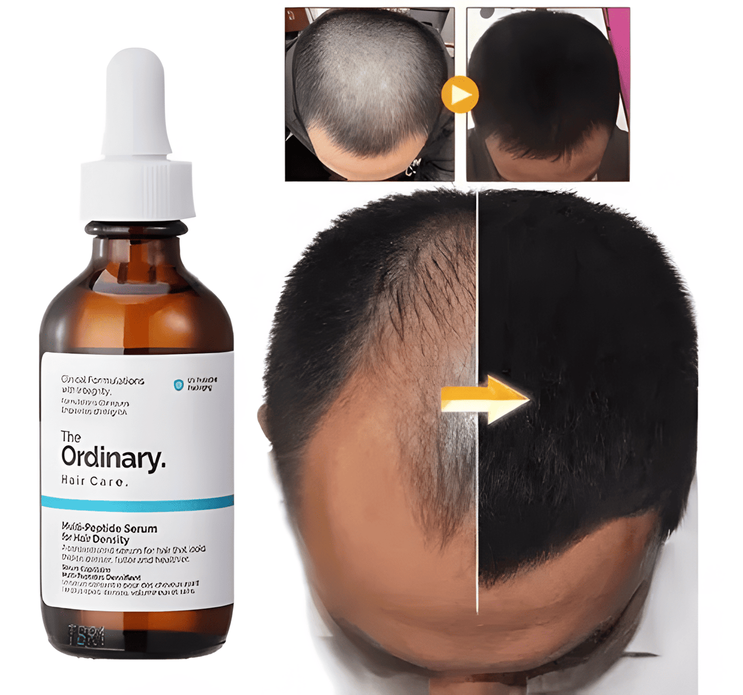 Sérum Capilar The Ordinary Multi-Péptido 30ml | Recupera tu Cabello desde la Raíz 🤩