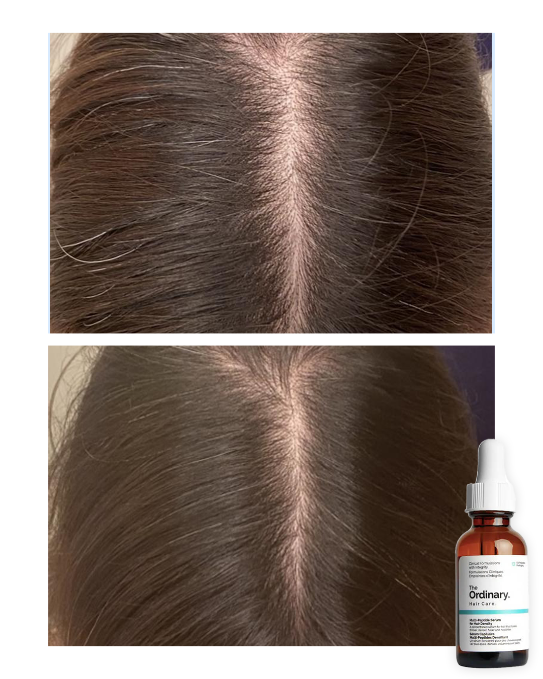 Sérum Capilar The Ordinary Multi-Péptido 30ml | Recupera tu Cabello desde la Raíz 🤩