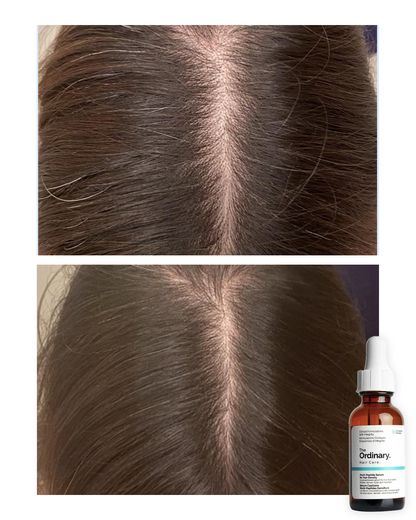 Sérum Capilar The Ordinary Multi-Péptido 30ml | Recupera tu Cabello desde la Raíz 🤩