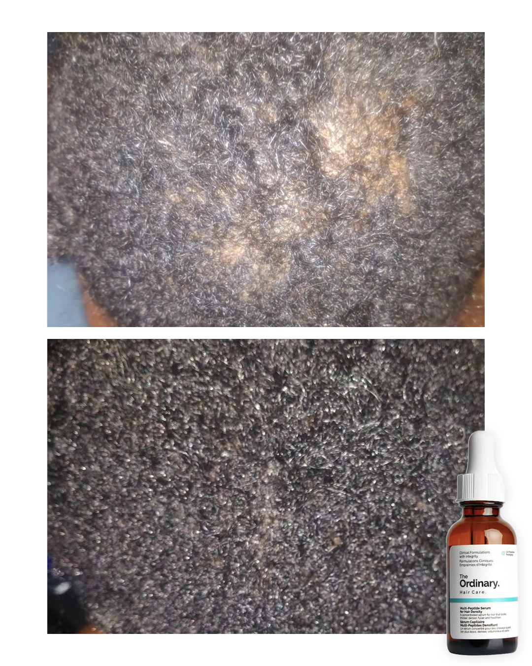 Sérum Capilar The Ordinary Multi-Péptido 30ml | Recupera tu Cabello desde la Raíz 🤩