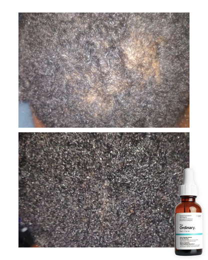 Sérum Capilar The Ordinary Multi-Péptido 30ml | Recupera tu Cabello desde la Raíz 🤩