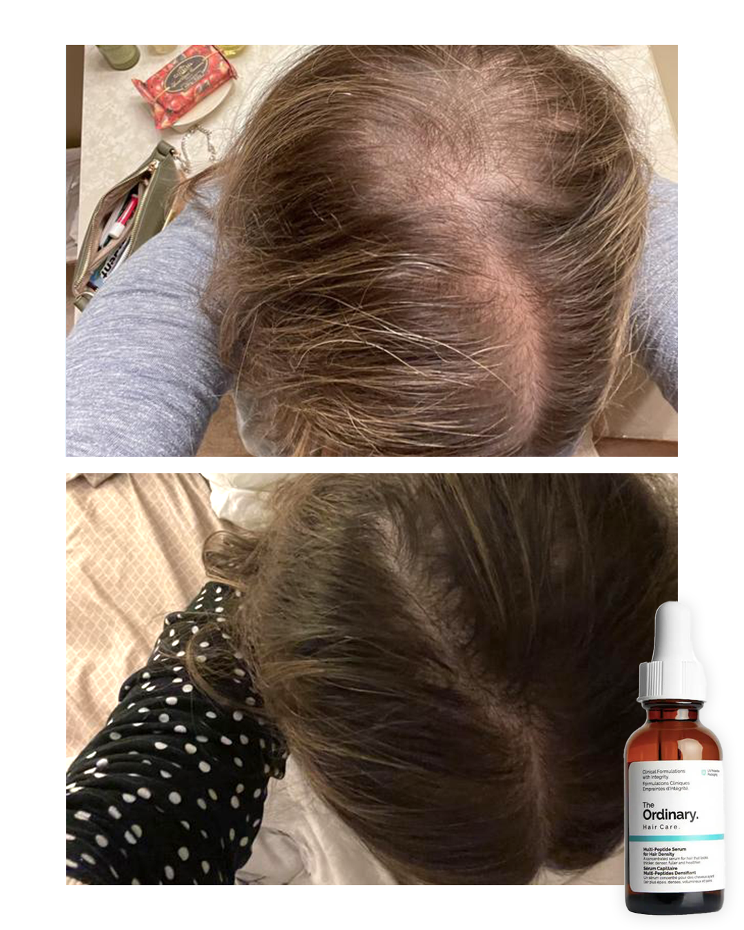 Sérum Capilar The Ordinary Multi-Péptido 30ml | Recupera tu Cabello desde la Raíz 🤩